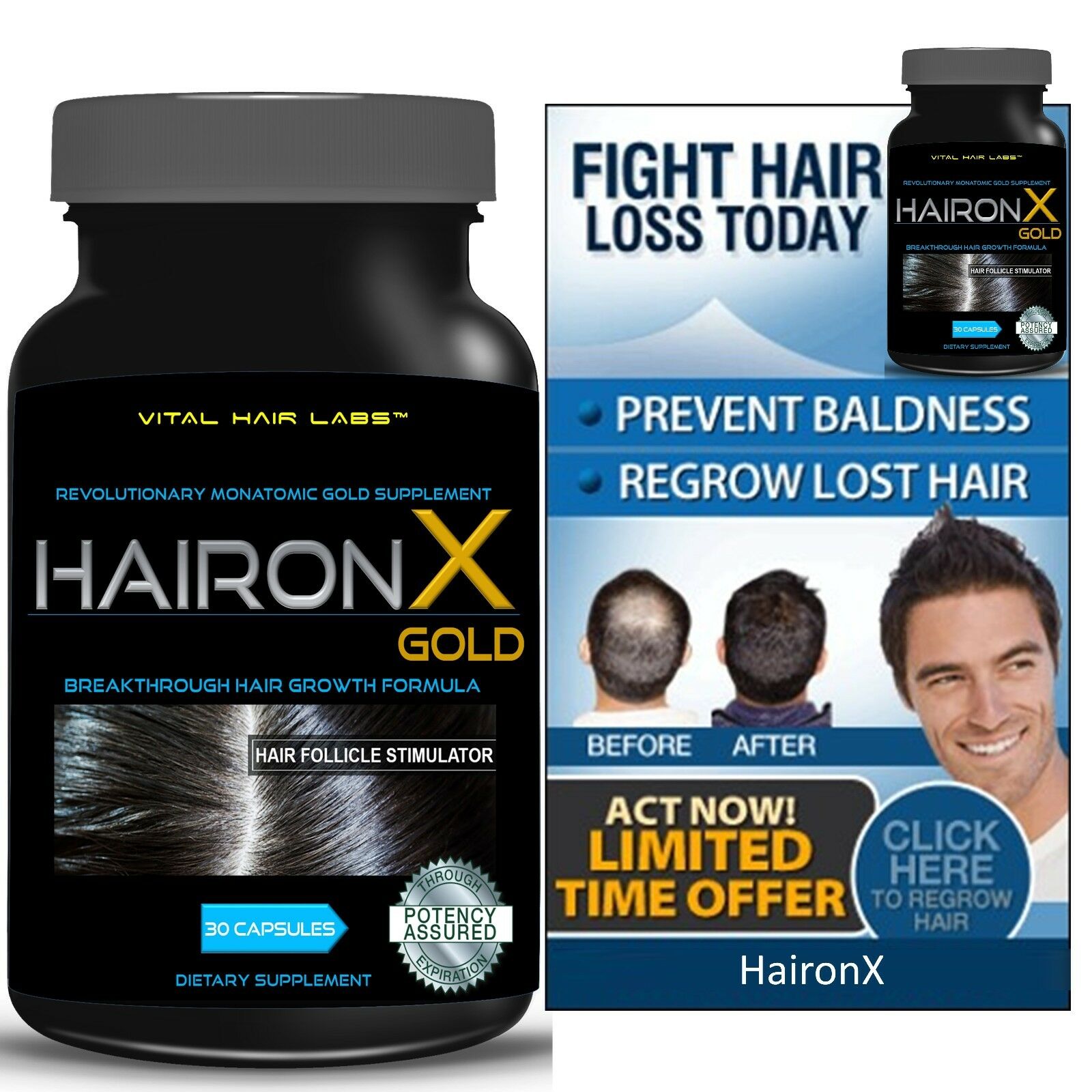 Hair Growth Vitamins Hair Loss Treatment For Faster Growth Guaranteed By Haironx
